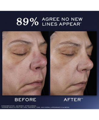 génifique ultimate recovery face serum-kollektion